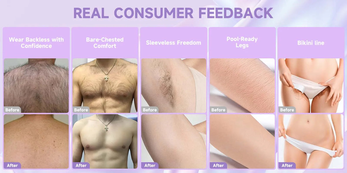 Gentle Hair Removal Cream for All Genders